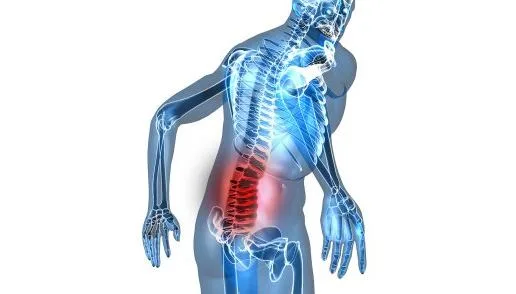 Efectos del Ejercicio en pacientes con Dolor Lumbar Crónico