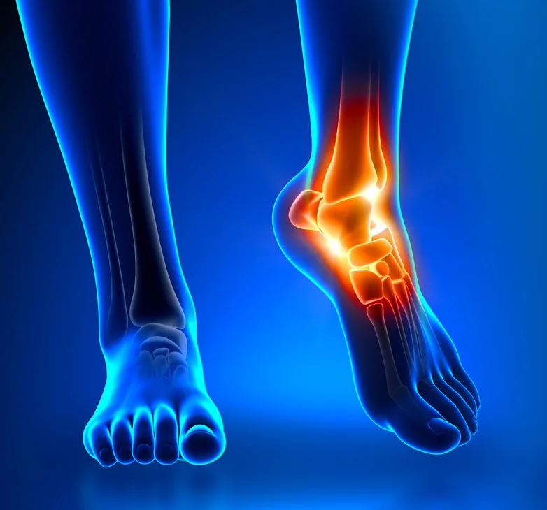 Esguince de Tobillo y Terapia Manual Ortopédica